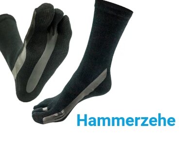 Hammerzehe